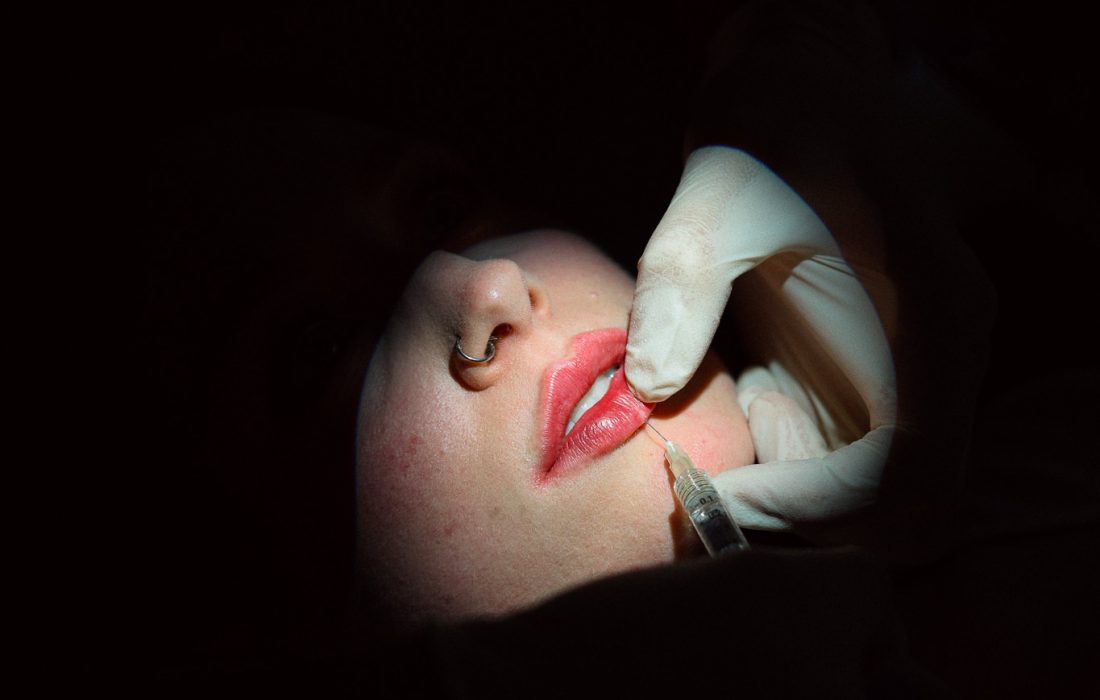 Filler e botulino_1