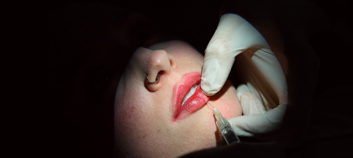 Filler e botulino_1