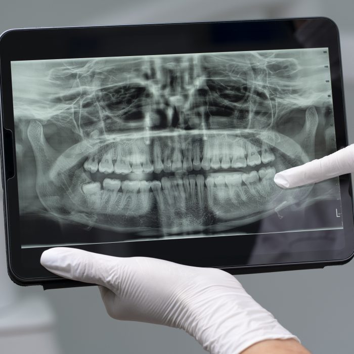 close-up-dentist-instruments (1)