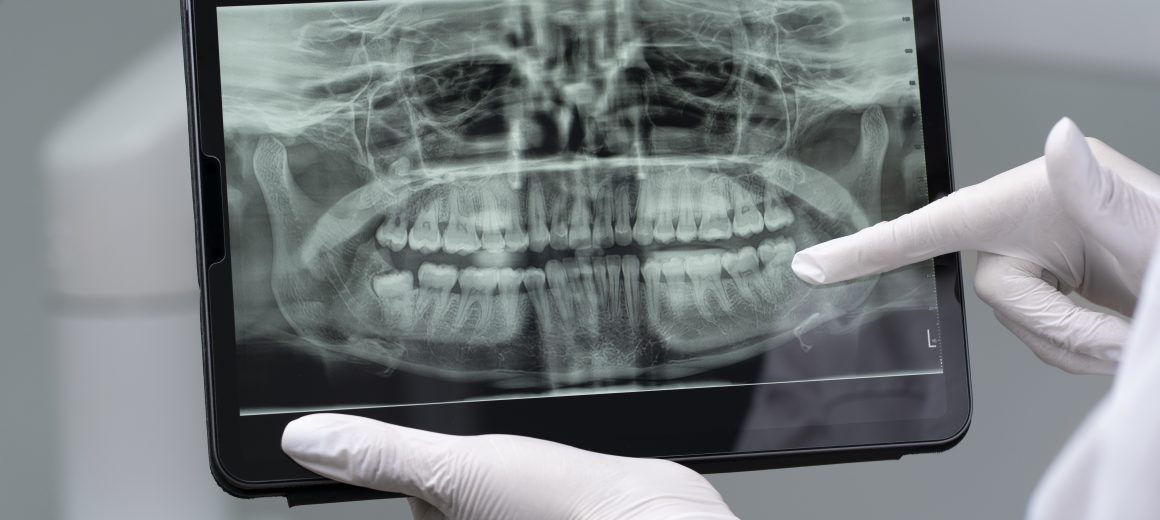 close-up-dentist-instruments (1)