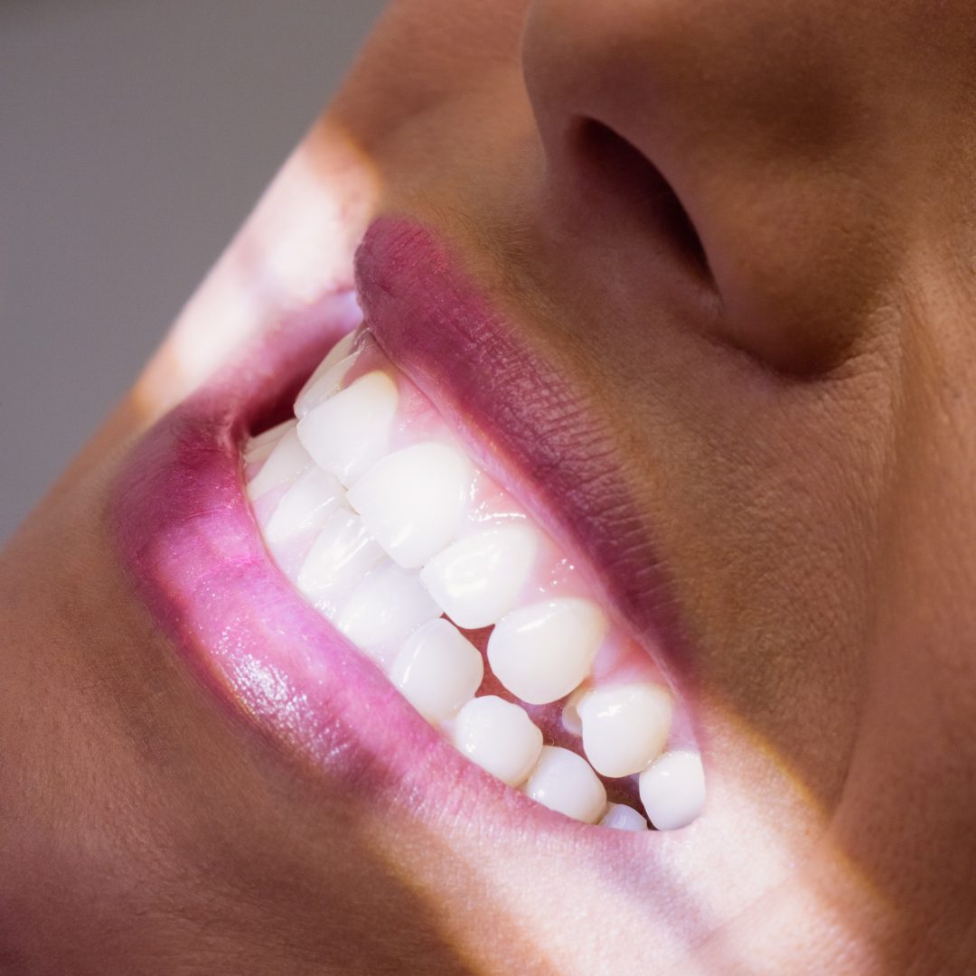 Close-up of female patient receiving a dental treatment at clinic