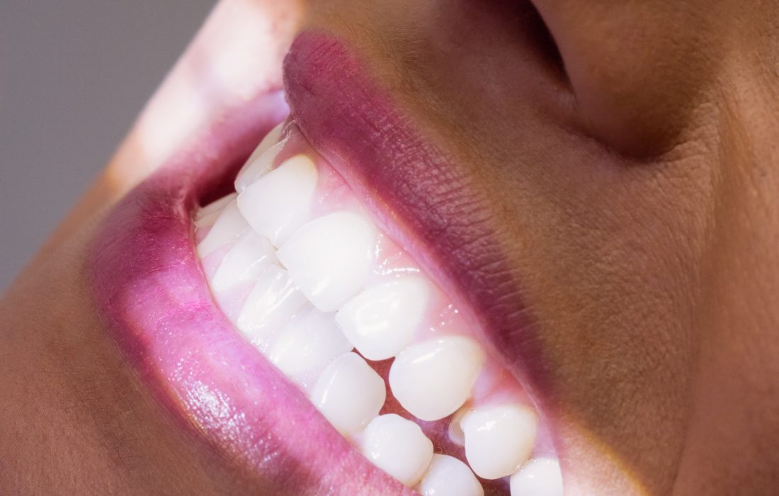 Close-up of female patient receiving a dental treatment at clinic